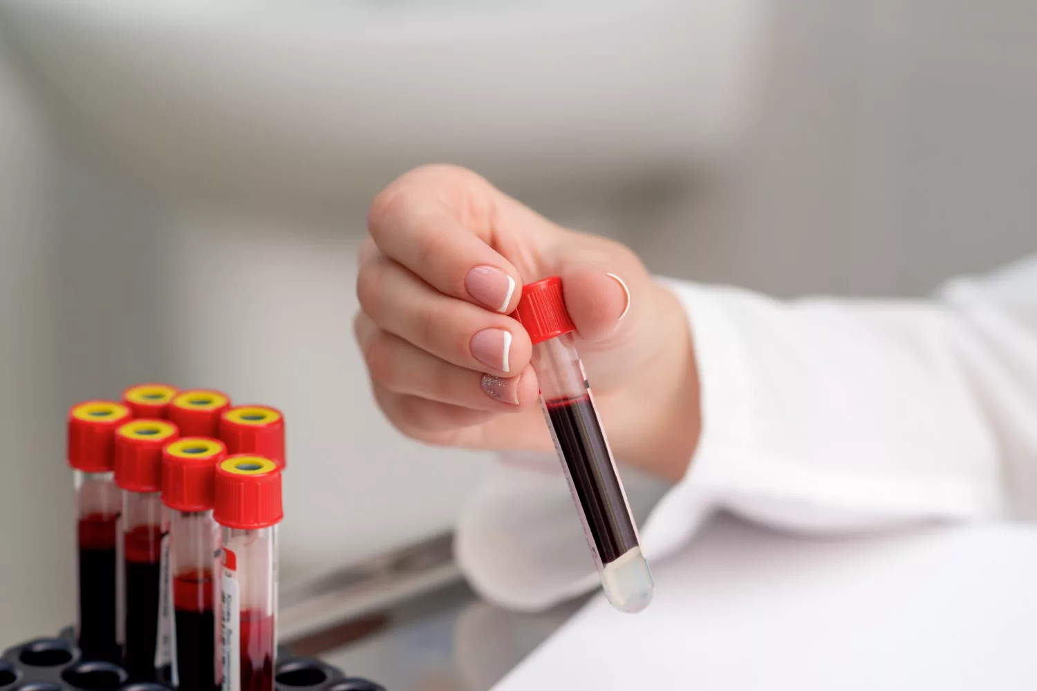 Sexual Health Screening